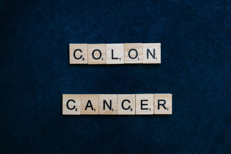 The words colon cancer written with scrabble pieces